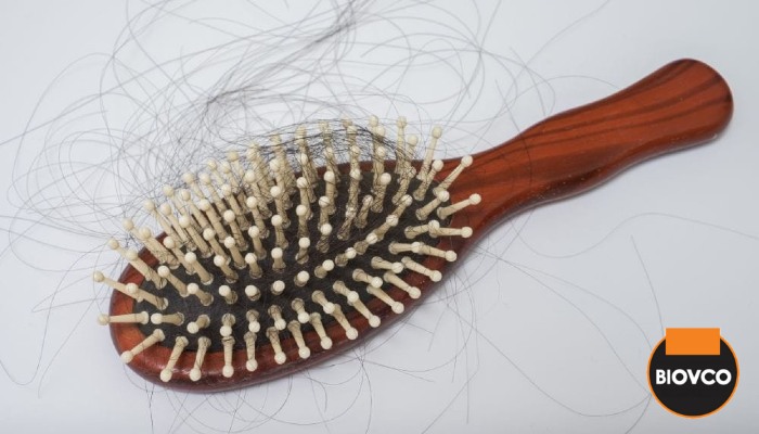 Masalah keguguran rambut dikenali dengan istilah alopecia dalam dunia perubatan